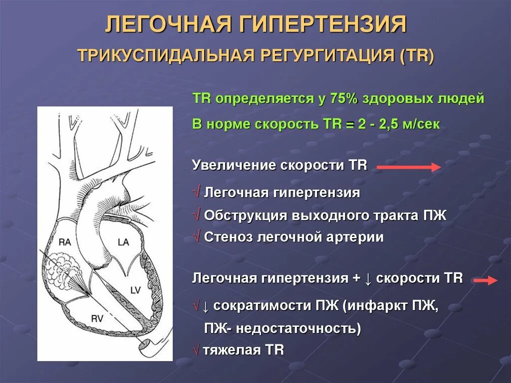 Легочная гипертензия на кт степени. Трикуспидальная регургитация 2 степени. Гипертензия легочной артерии. Ертензия легочной артерии. Легочная гипертензия сдла