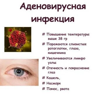 Аденовирусная инфекция у детей клинические