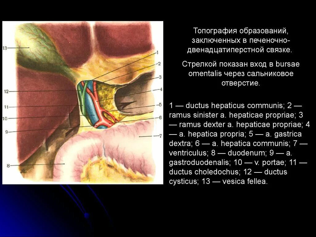 Винслово отверстие. Печеночно-двенадцатиперстной связки. Топография печеночно-двенадцатиперстной связки. Сальниковое винслово отверстие. Печеночно 12 перстная связка.