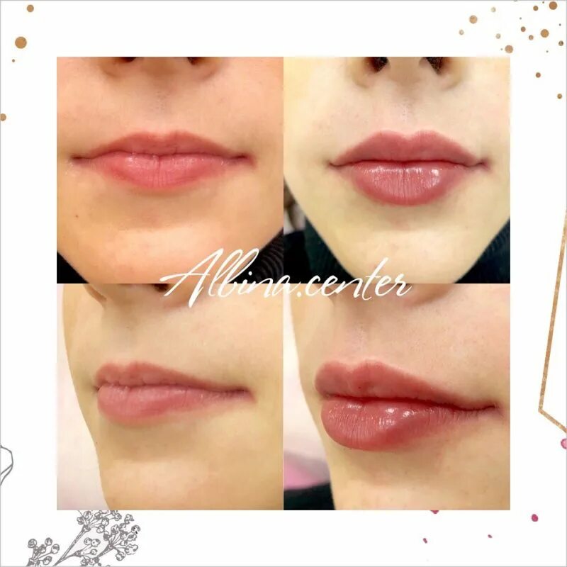 лук купидона губы