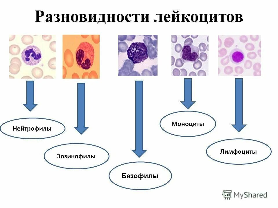 Как обозначаются лимфоциты в крови. Разновидности лейкоцитов базофилы. Строение разных видов лейкоцитов. Основные формы лейкоцитов рисунок. Лейкоцитарная формула функции лейкоцитов таблица.