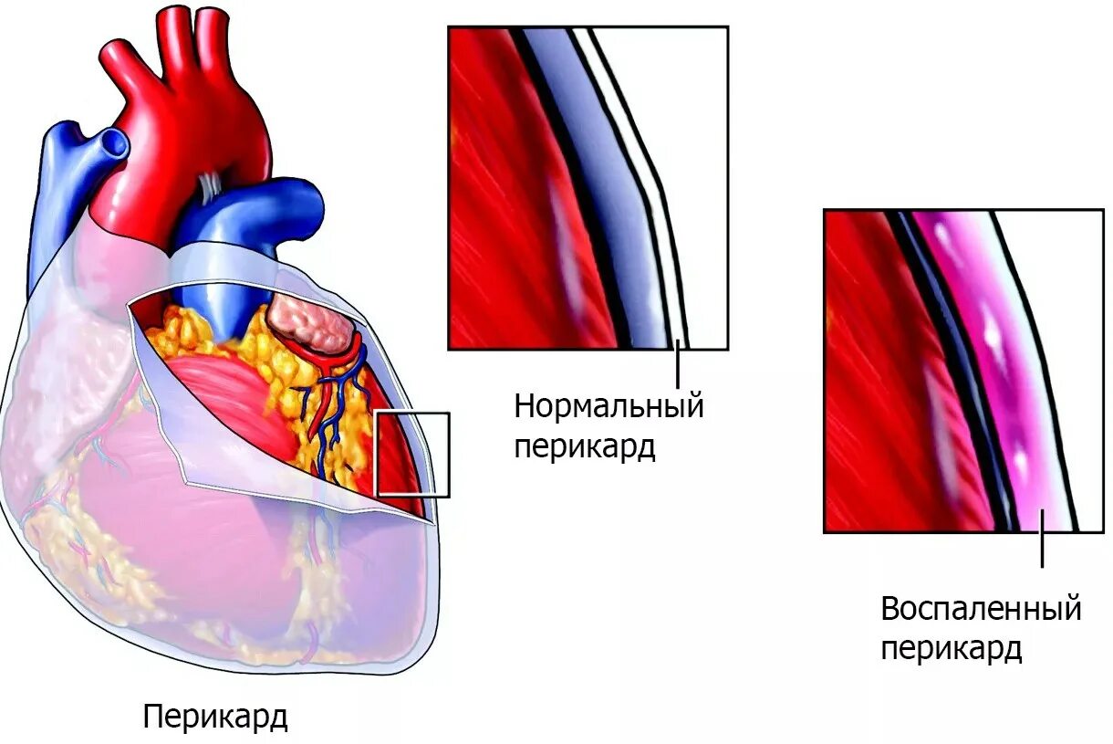 Экссудативный перикардит у животных. Околосердечная сумка. Перикард строение анатомия отделы. Строение околосердечной сумки. Околосердечная перикард.