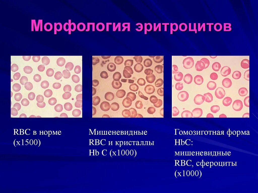 Морфология эритроцитов анализ. Морфология эритроцитов в норме. эритроциты рисунок. морфология эритроцитов в крови. строение эритроцитов.