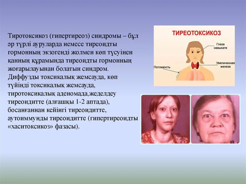 Гипертиреоз симптомы у женщин после 40. Синдромы при гипертиреозе. Осложнения гипертиреоза.