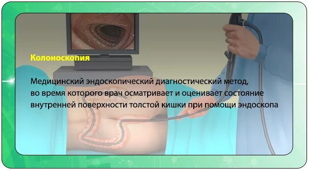 Колоноскопия можно ли чай. Колоноскопия препараты для подготовки. Колоноскопия кишечника. Колоноскопия картинки.