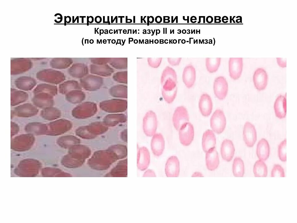 Зарисуйте эритроцит. Кровь человека азур-эозин по романовскому. зарисуйте эритроциты крови человека. эритроциты крови человека и лягушки. кровь человека азур 2 эозин.