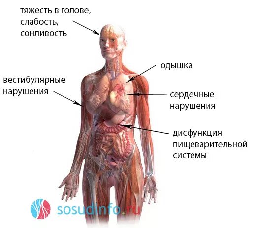 Сосудистая дистония. Вегетососудистые расстройства это. Нейроциркуляторная астения по кардиальному типу. Нцд по кардиальному типу. Ваготония симптомы