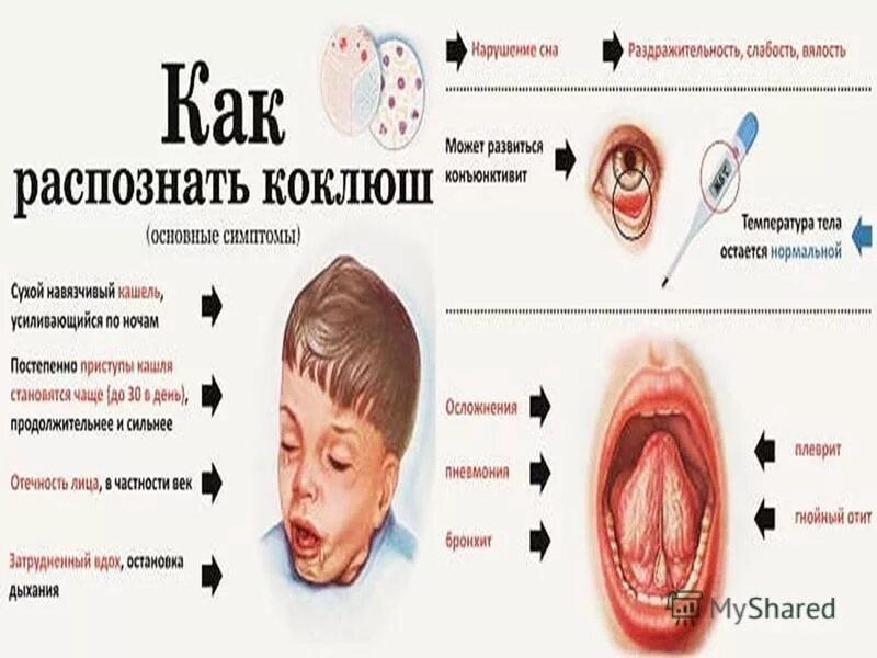 Повторно заболеть коклюшем