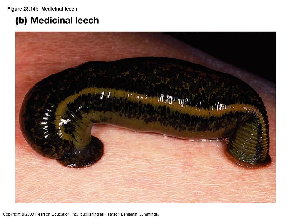 The Ministry Pages: Leech Speech