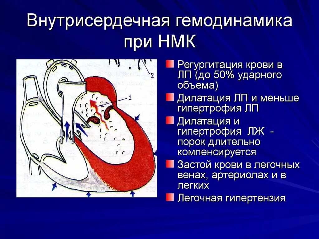 Внутрисердечная гемодинамика. Изменение гемодинамики при недостаточности митрального клапана. Изменение гемодинамики при митральной недостаточности. Механизмы нарушения гемодинамики при пороках сердца. Митральная недостаточность гемодинамика.