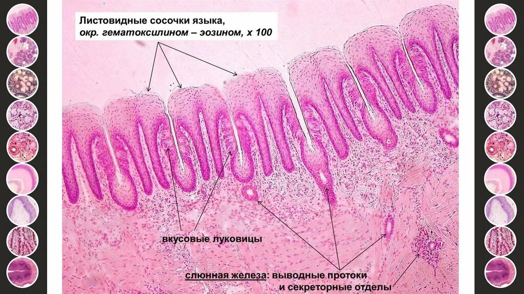 листовидные сосочки. листовидные сосочки. листовидные сосочки языка гистология. листовидные сосочки гистология препарат. листовидные сосочки строение гистология.