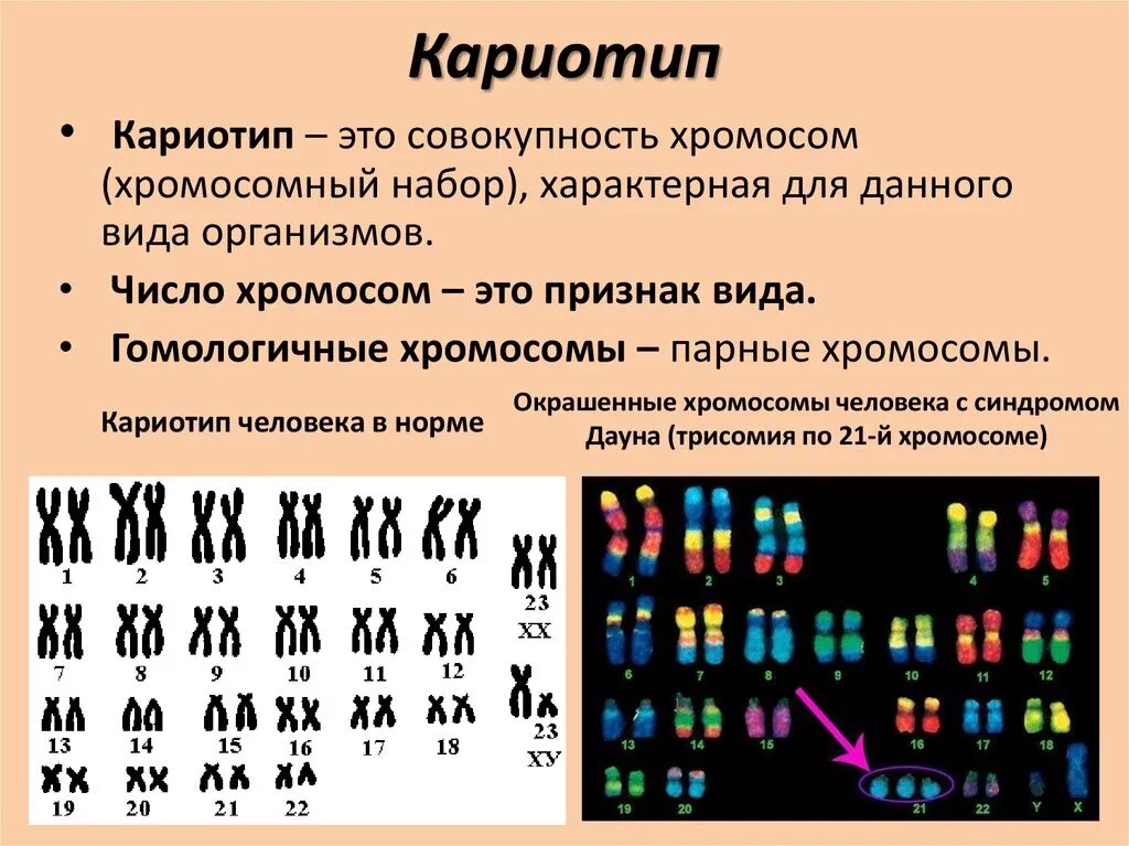 Кариотипирование супругов цена. Кариотип человека набор хромосом. Нормальный кариотип человека 46 хромосом. Хромосомный набор кариотип человека. Кариотип человека. Набор хромосом женщины.