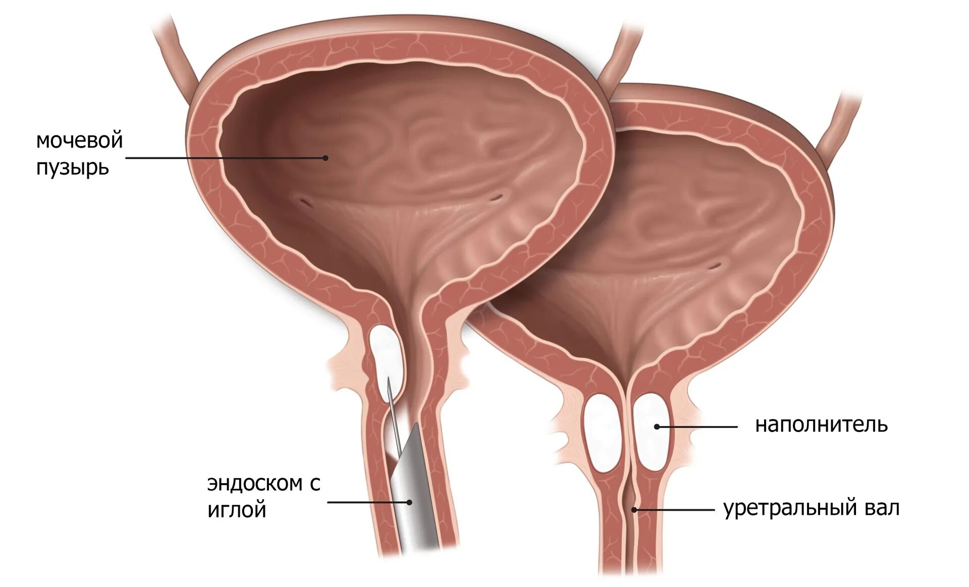 Болит полный мочевой пузырь. Мочевой пузырь и мочеиспускательный канал. Сфинктеры мочевого пузыря и уретры. Мочевой пузырь, мужской мочеиспускательный канал.