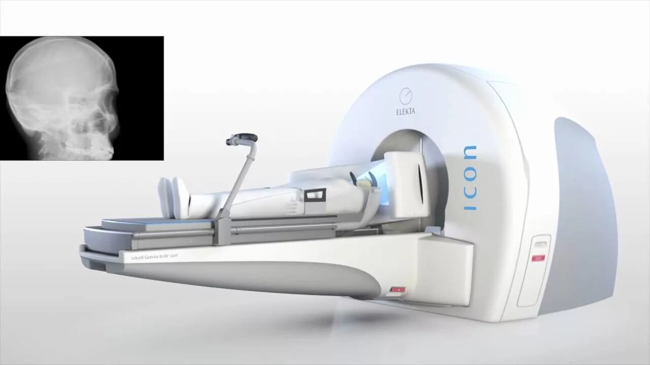 Гамма нож icon. Аппарат гамма нож. Leksell Gamma Knife Perfexion.