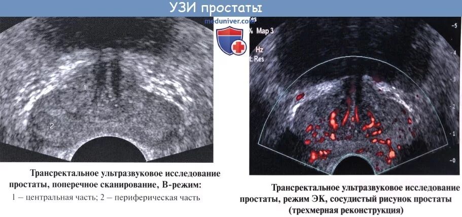 Простата у человека
