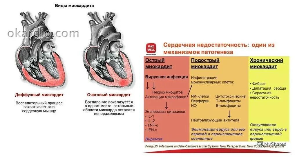 Миокардит у животных сердце. Миокардит сердечная недостаточность. Этиология эндокардита миокардита перикардита. Миокардит острая сердечная недостаточность. Сердечная недостаточность схема