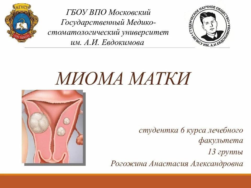 Формы миомы матки. Миома матки презентация. Презентация на тему миома матки.