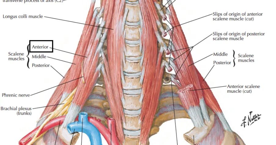 Лестничные мышцы шеи анатомия. Задняя лестничная мышца анатомия. Передняя средняя и задняя лестничные мышцы. Синдром лестничной мышцы.