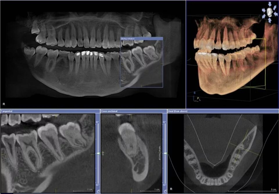 Где сделать кт зуба. Кт 3d верхней и нижней челюсти. Кт 3д зубочелюстной системы.