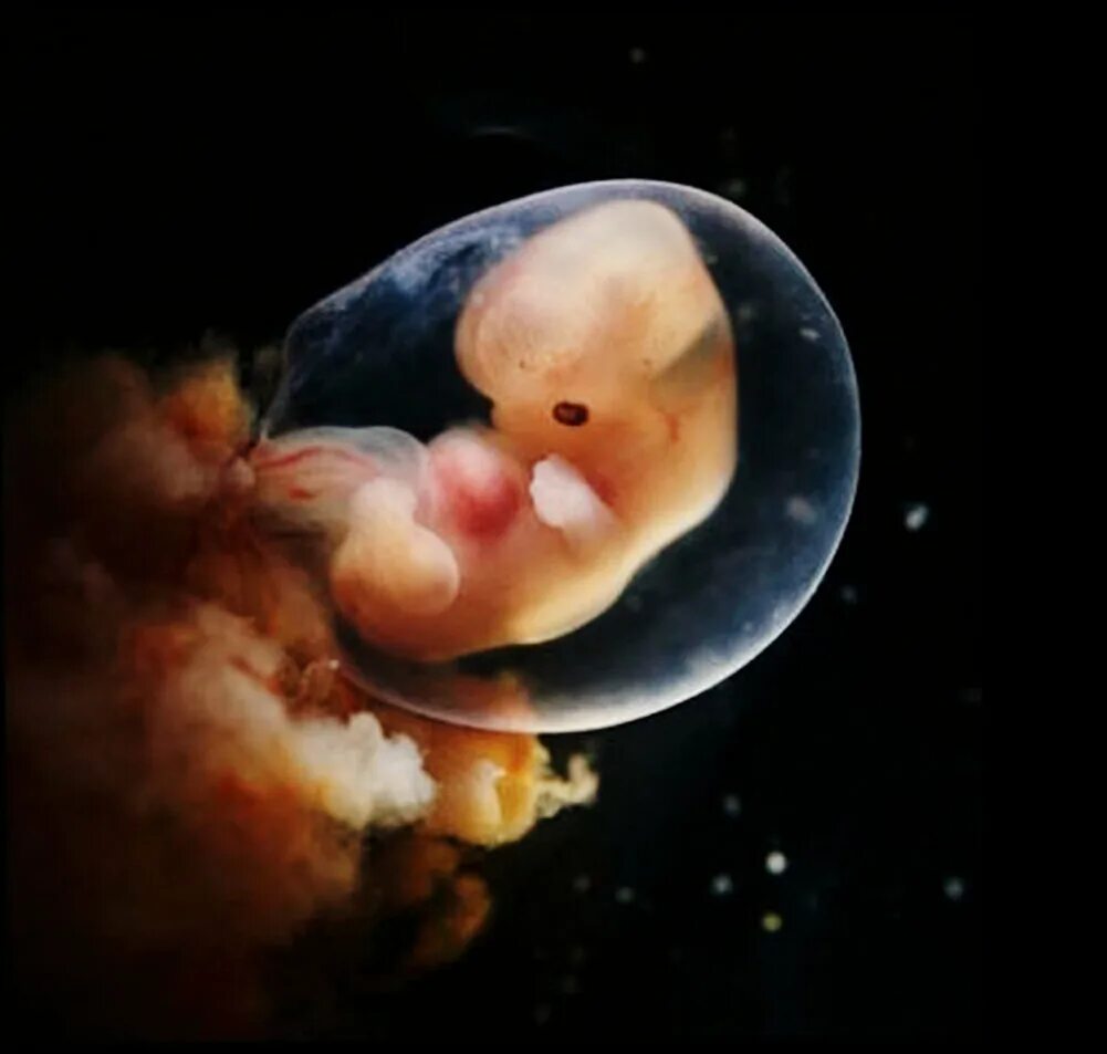Эмбрион Леннарт Нильсон. Леннарт Нильсон Зарождение. Зародыш 6-7 недель беременности. 7 Недель беременности фото эмбриона.