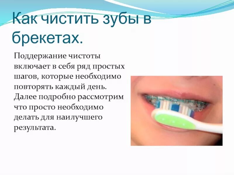 Как чистить зубы с брекетами щеткой. Как чистить зубы с брекетами. памятка как чистить зубы с брекетами. что нужно для чистки зубов с брекетами. схема чистки зубов при брекетах.