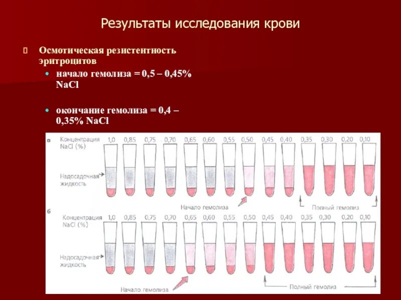 Резистентность крови. Методика исследования осмотической стойкости эритроцитов. Норма осмотической стойкости эритроцитов. Измерение осмотической устойчивости эритроцитов. Исследование осмотической резистентности эритроцитов норма.