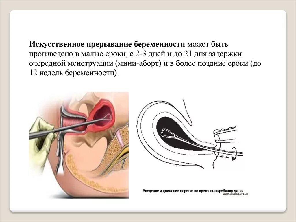 Содержание прервать