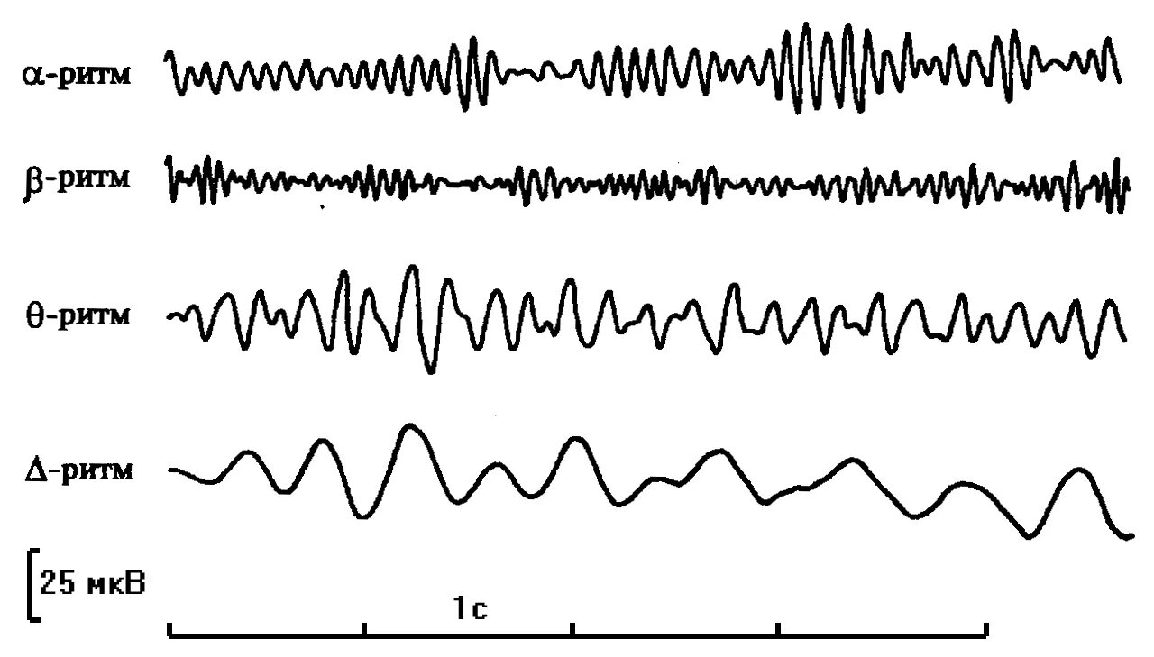 Ээг 7. Альфа ритм ЭЭГ. Ритмы ЭЭГ график. Амплитуда Альфа-ритма ЭЭГ. Дельта ритм ЭЭГ.