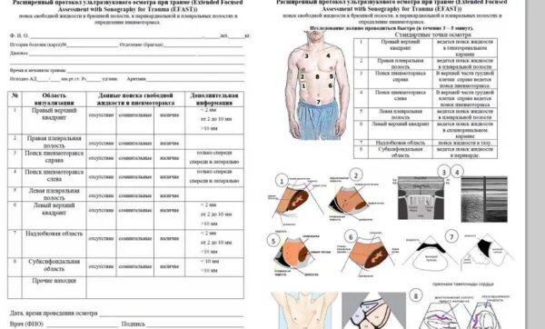 Fast протокол УЗИ. E fast протокол УЗИ. Fast протокол УЗИ при травме. Fast протокол при травме. Fast протокол