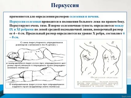 Перкуссия определение
