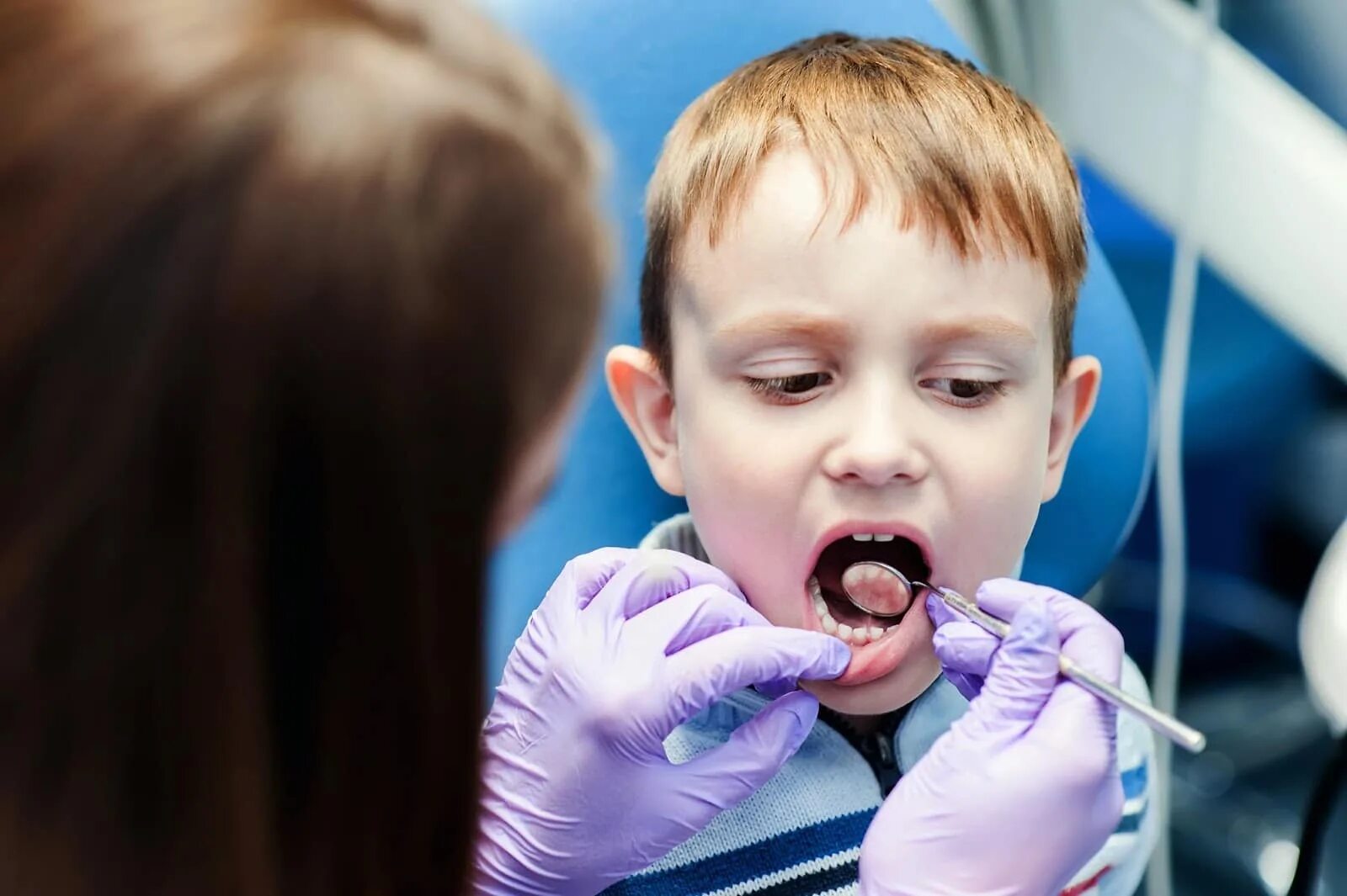 Пульпотомия молочных зубов. Детский пульпит молочных зубов. Пульпит молочных зубов детская стоматология. Детские лица кариес.