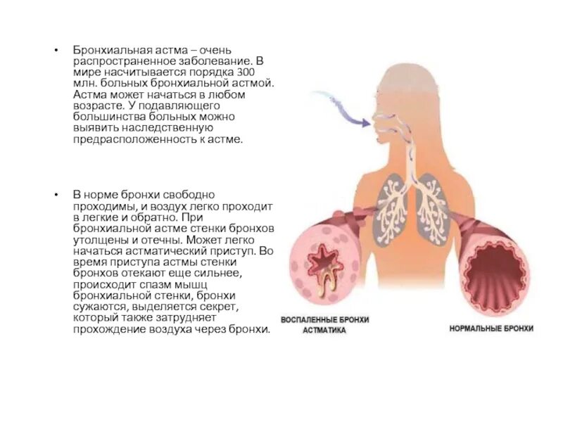 Сколько живут с астмой