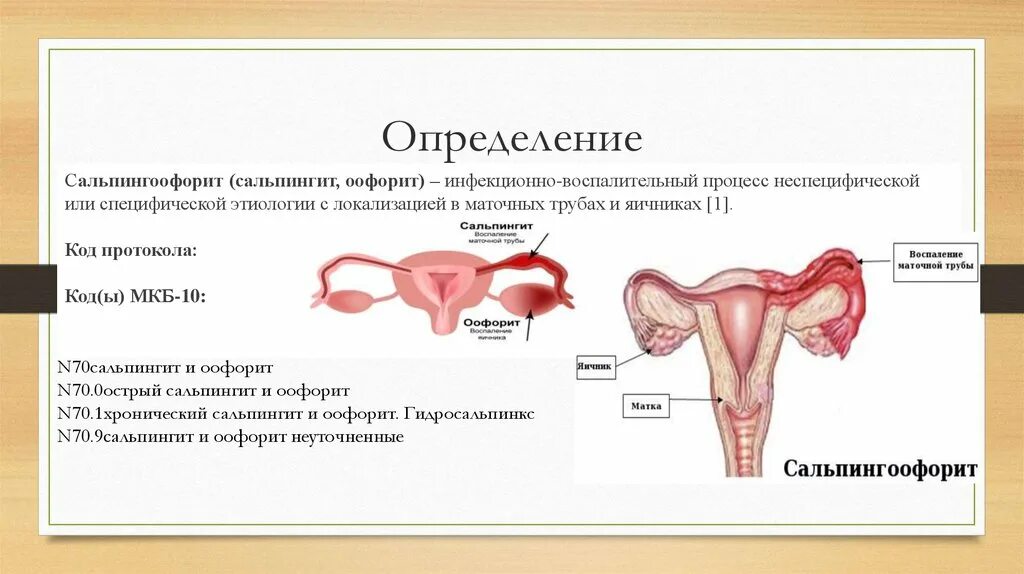 Сальпингит и оофорит что это. Сальпингит и сальпингоофорит. острый сальпингит и оофорит. хронический сальпингоофорит этиология. хронический сальпингит и оофорит.