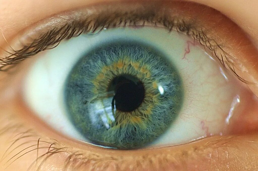 Желтоватый оттенок зеленого цвета. Центральная гетерохромия голубых глаз. Центральная гетерохромия голубой Карий зелёный. Центральная гетерохромия карих глаз. Центральная гетерохромия зеленый желтый.