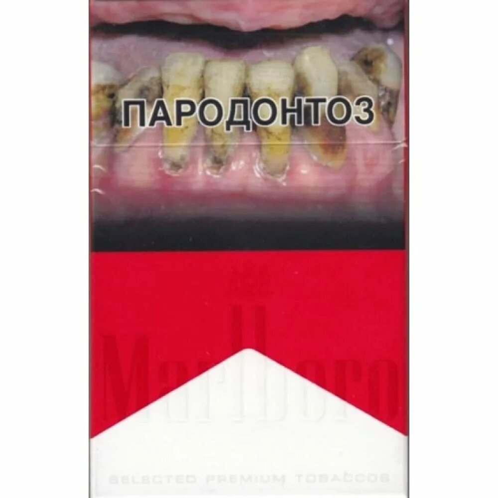 Сигара во рту. Упаковка сигарет. Сигареты пародонтоз. Изображения на сигаретных пачках. Надписи на пачках сигарет.