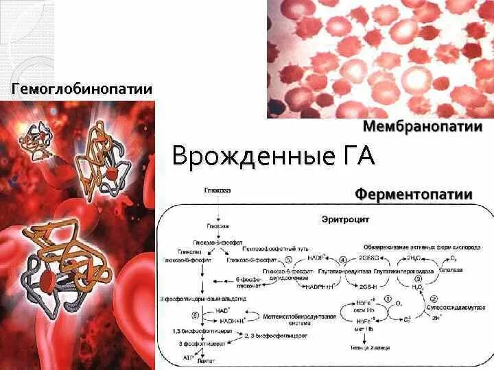 Гемоглобинопатия биохимия. Талассемия биохимия. Гемоглобинопатии патогенез. Гемоглобинопатии и талассемии биохимия.