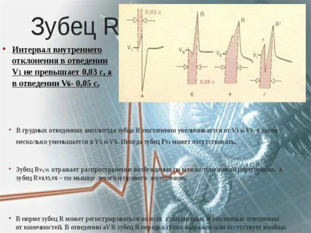 Нарастание зубца r. Высокий зубец r в v1 на ЭКГ. Высокие зубцы r в v1-v3 на ЭКГ. Амплитуда зубца r r в v1-v4. ЭКГ- отведение v-1 - расщепление зубца r.