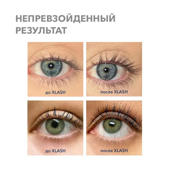 X lash для роста. Xlash Eyelash Serum. Xlash сыворотка. Сыворотка для ресниц Xlash. Xlash сыворотка для роста ресниц.