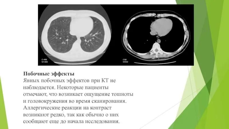 Что есть и пить после кт