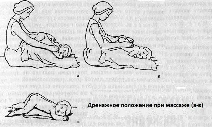 Массаж при бронхите у детей для отхождения. Дренажный массаж ребенку для отхождения мокроты. постуральный дренажный массаж для ребенка. массаж для отхождения мокроты грудничку. вибрационный массаж для детей для отхождения мокроты грудничку.