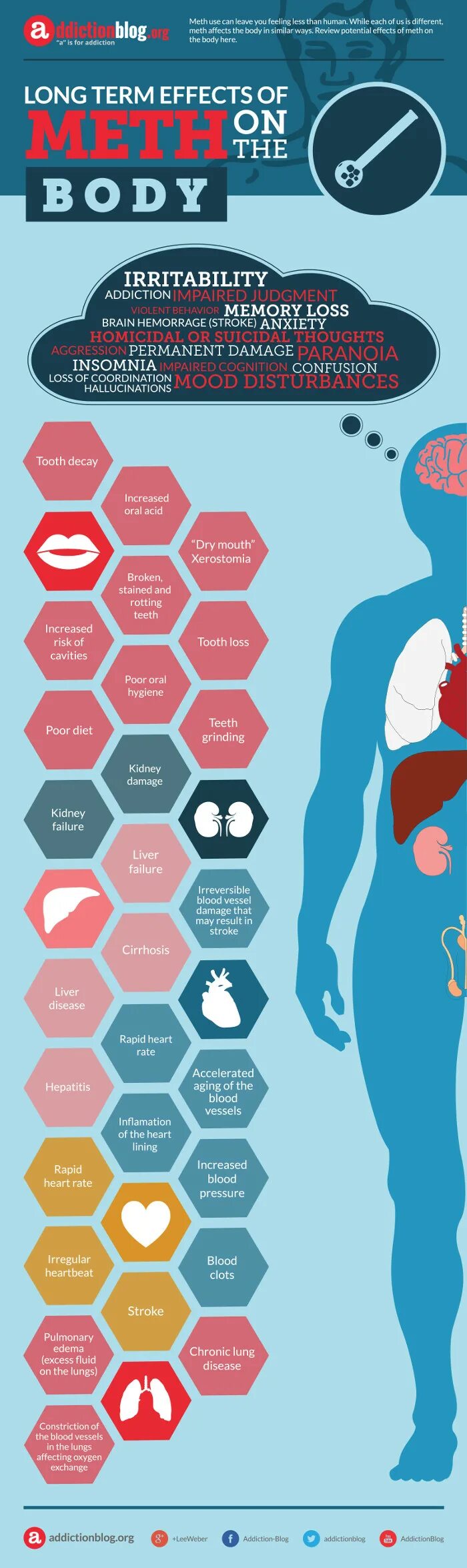 Инфографика психология. Красное боди инфографика. Infographics about Insomnia. Effect terms