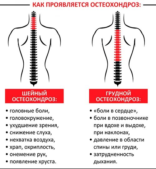 Боли при грудном остеохондрозе. Шейно-грудной остеохондроз. Грудной остеохондроз локализация боли. Боль при остеохондрозе грудного отдела.