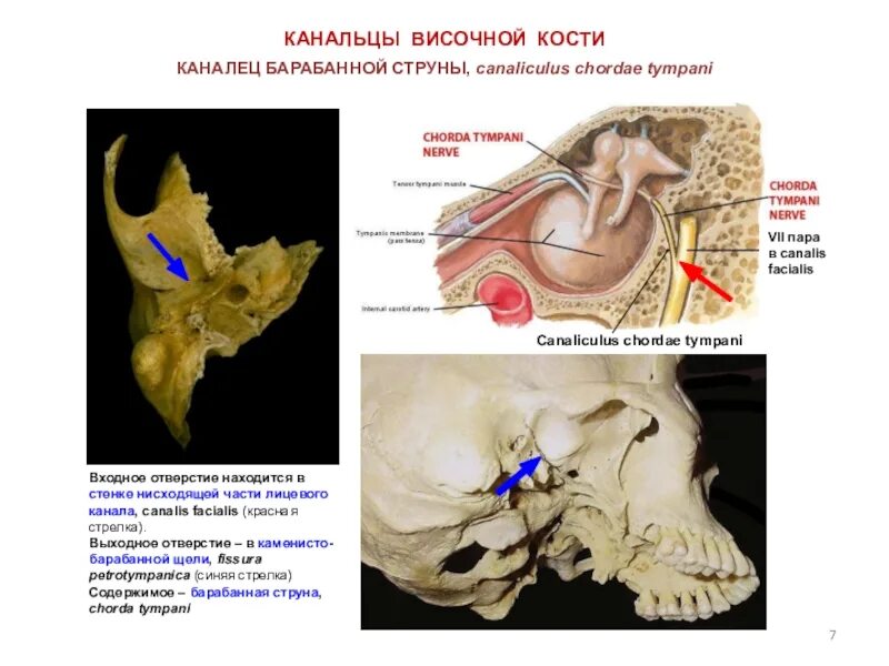 Тип соединения височной кости. Височная кость мышечно трубный канал. сонно барабанный канал височной кости. каналис каротикус височной кости. сосцевидный каналец височной кости.