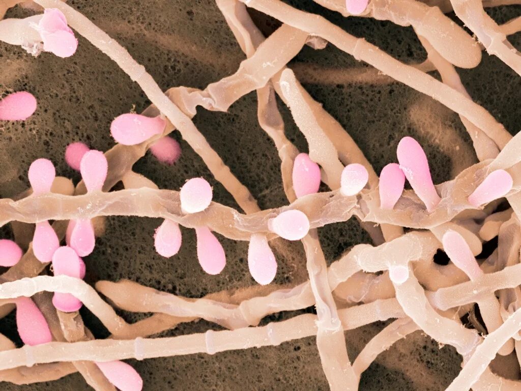 Плесень аспергилл черный. Споры кожи. Дрожжеподобные грибы рода candida. Споры кожи. Споры кожи.