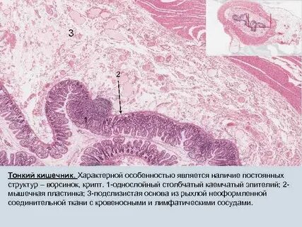 Для толстой кишки характерны