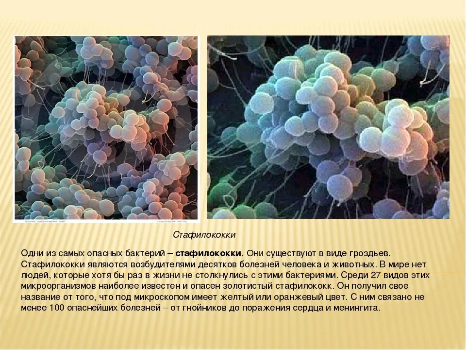 Вред наносимый бактериями. Про вредных бактериях про золотистые стафилококки. Стафилококк 3.3. Опасные бактерии названия. Вредные микроорганизмы для человека.