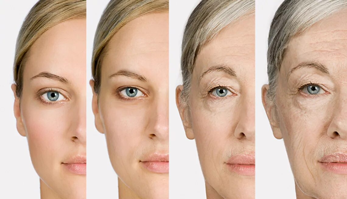 Ageing net