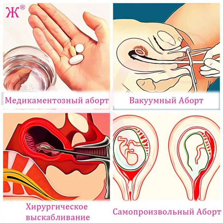 Как сделать оборот самой