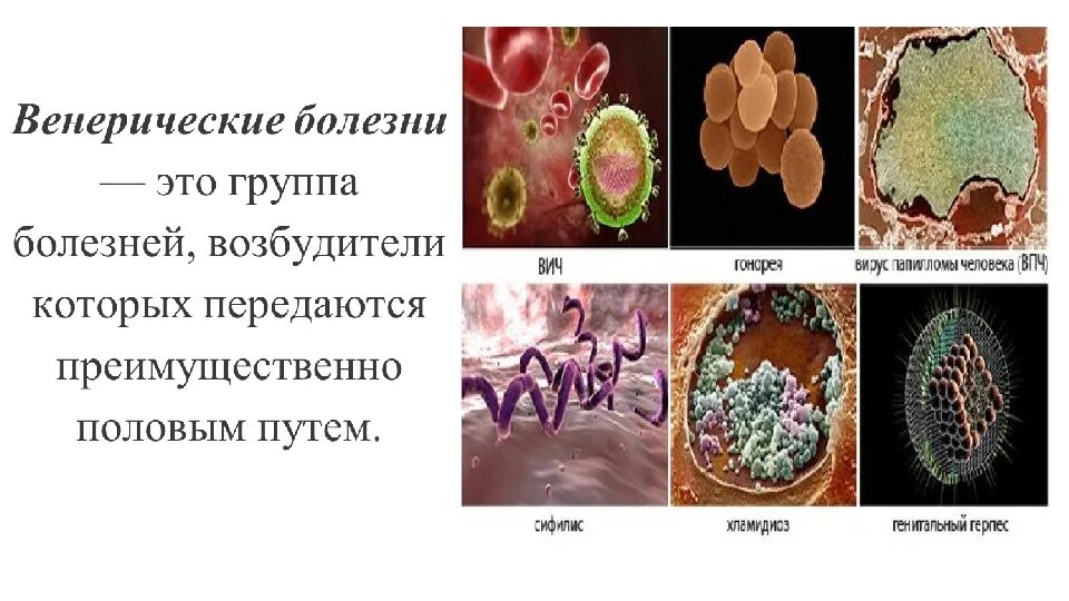 Заболевания передающиеся микроорганизмами. Инфекции половых путей. Возбудители заболеваний передающихся половым путем. Инфекции и заболевания передающиеся половым путем. Инфекционные болезни и болезни передаваемые половым путем.