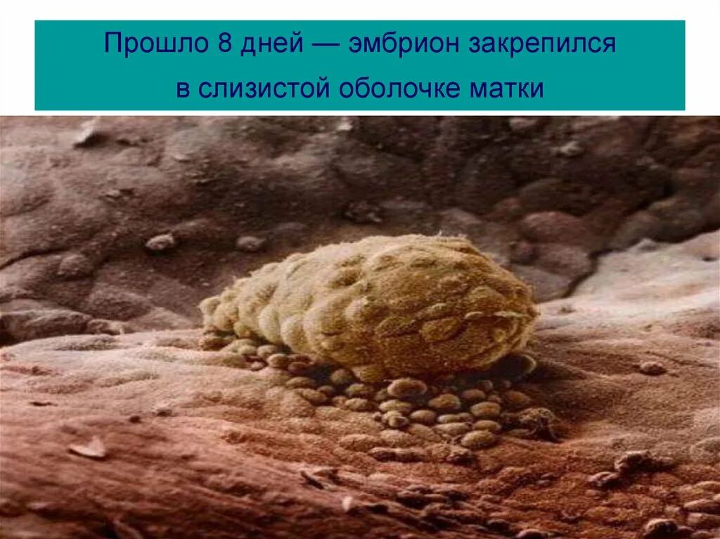 Прикрепление эмбриона к матке симптомы ощущения. Эмбрион прикрепляется к матке. матка и прикрепившийся плод. прикрепленный эмбрион к матке. эмбрион не прикрепился к матке.